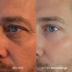 DermaForge® – Advanced Men's Collagen Cream | Anti-Wrinkle Formula