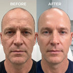 DermaForge® – Advanced Men's Collagen Cream | Anti-Wrinkle Formula