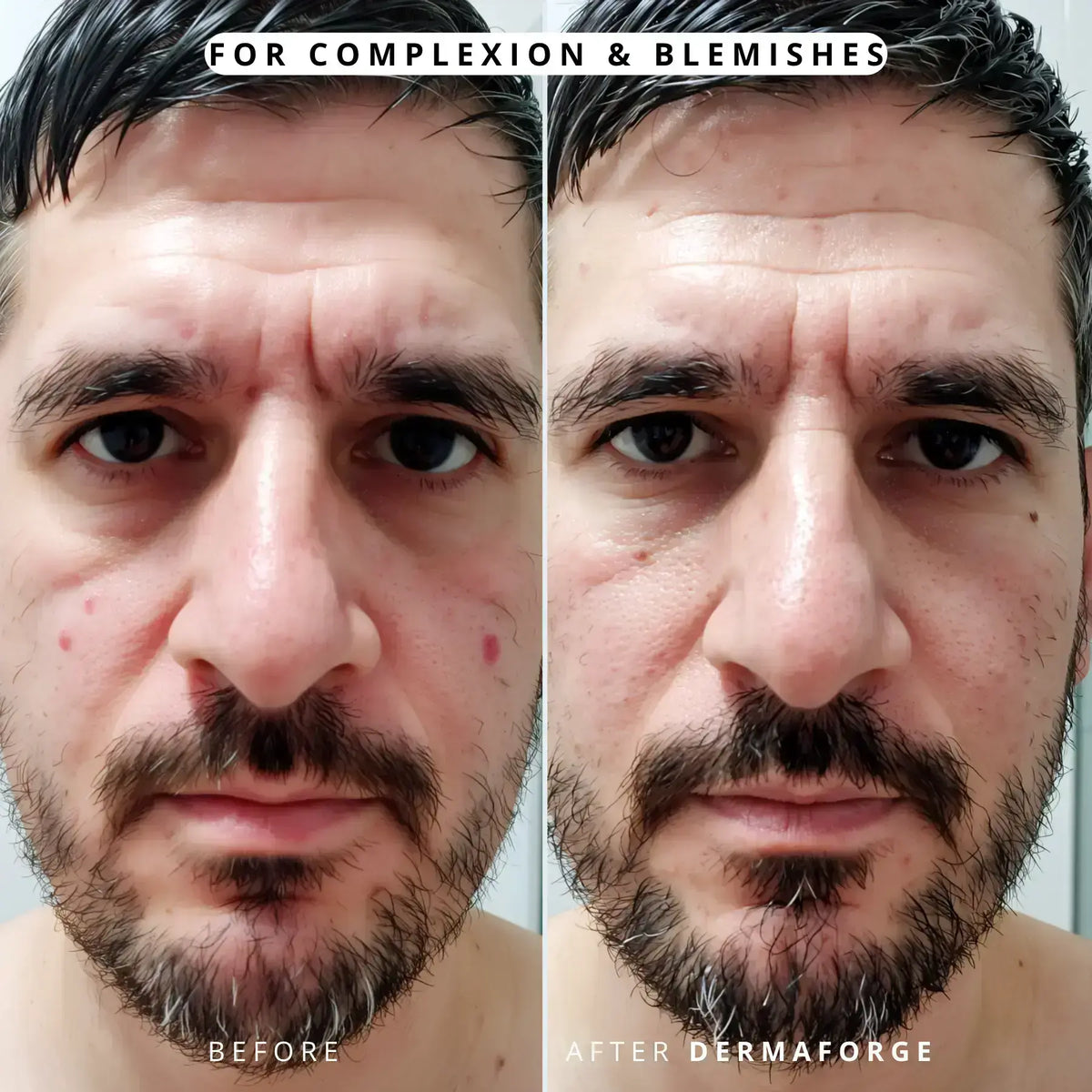 DermaForge® – Advanced Men's Collagen Cream | Anti-Wrinkle Formula