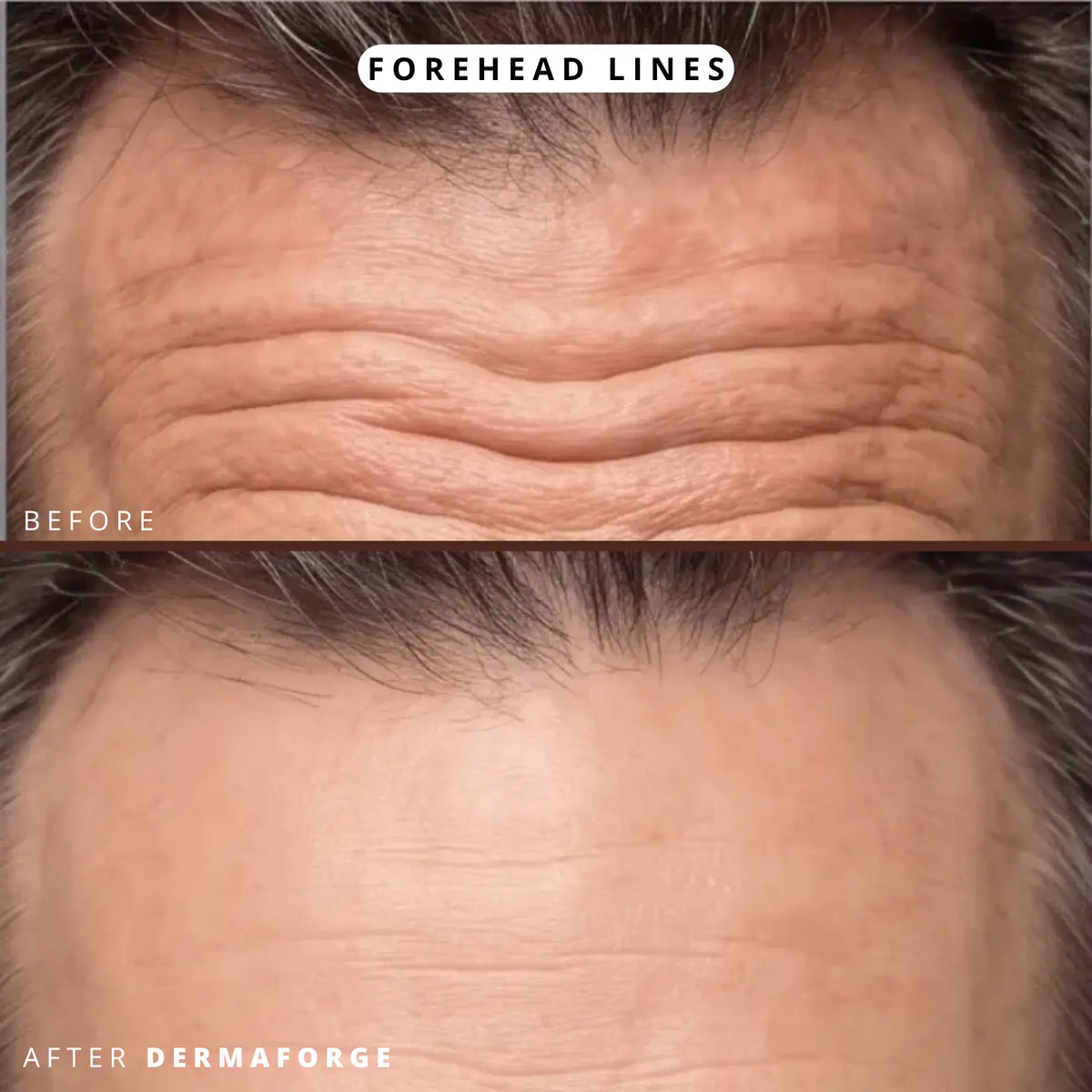 DermaForge® – Advanced Men's Collagen Cream | Anti-Wrinkle Formula